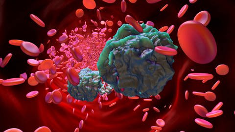 Dreidimensionale Darstellung von Leukämiezellen im Blutstrom (Foto: IMAGO, Westend61)