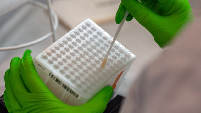 Eine Mitarbeiterin im DKMS Life Science Lab arbeitet an der Einsortierung der medizinischen Wattestäbchen mit Zellen der Wangenschleimhaut für den Typisierungsprozess der DNA. (Foto: picture-alliance / Reportdienste, Picture Alliance)