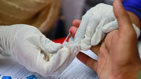 Ein Gesundheitsarbeiter nimmt eine Blutprobe für einen HIV-Test ab.  (Foto: IMAGO, IMAGO / ZUMA Wire)