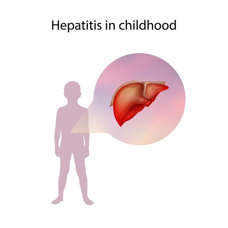 Hepatitis bei Kindern (Foto: IMAGO, imago)