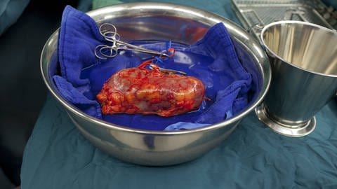 Entnommene Niere bei einer Nierentransplantation.