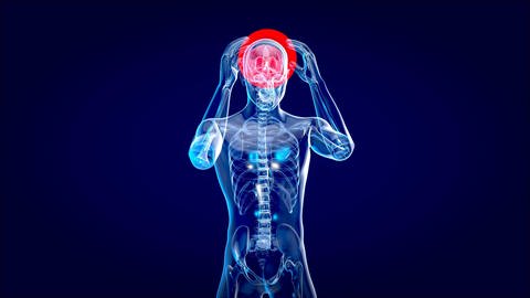 3D Illustration eines menschlichen körpers, bei welchem der Bereich des Gehirns rot gekennzeichnet ist. Der Mensch fasst sich mit beiden Händen an den Kopf.