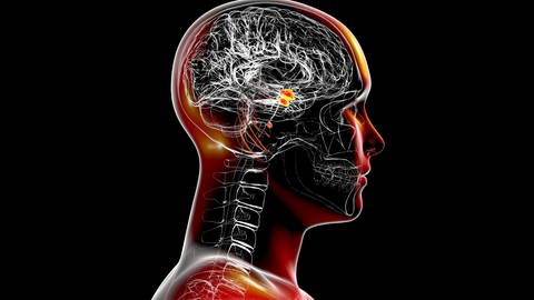 Die Amygdala (Mandelkern) spielt eine wichtige Rolle bei der emotionalen Bewertung und Wiedererkennung von Situationen und der Analyse möglicher Gefahren. Lärm kann die Amygdala aktivieren und zusätzlichen Stress erzeugen.