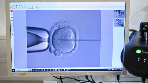 Eizelspende bzw. Leihmutterschaft: In einem Reproduktionszentrum wird eine Eizelle mit Hilfe eines Elektronenmikroskops befruchtet. (Symbolbild) (Foto: picture-alliance / Reportdienste, picture alliance/dpa | Jens Kalaene)