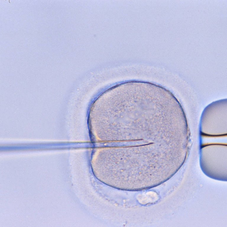 Künstliche Befruchtung unter dem Mikroskop (Foto: IMAGO, / Jochen Tack)