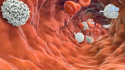 Illustration einer Blutbahn, in der Antikörperzellen Tumorzellen zerstören. (Foto: IMAGO, IMAGO / Zoonar)
