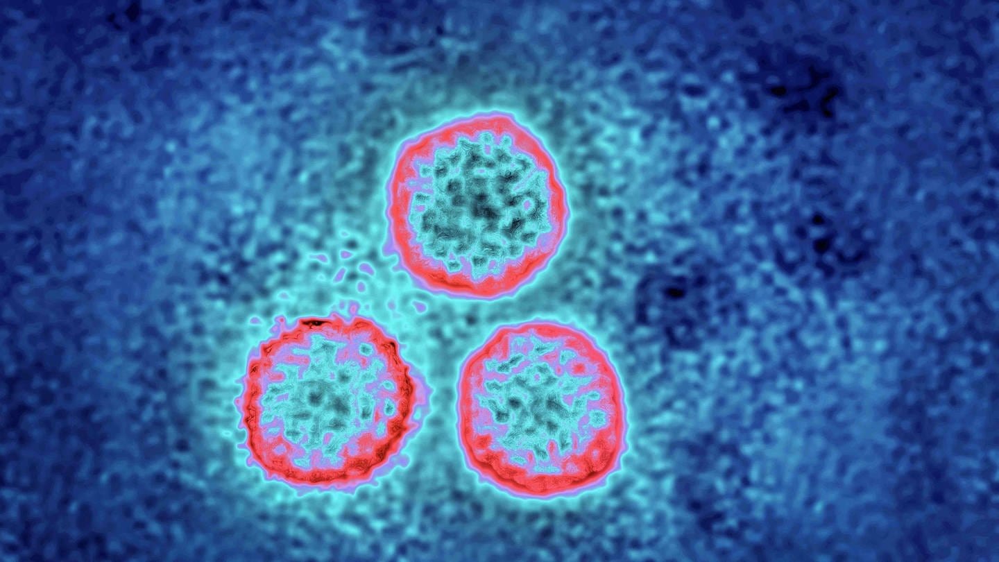 Human Papilloma Viren unter dem Mikroskop (Foto: IMAGO, UIG)