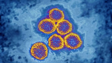 Viren aus der Flavivirus-Familie sind für Gelbfieber, Dengue-Fieber, Japanische Enzephalitis, Zika-Virus und West-Nil-Enzephalitis verantwortlich. Sie werden durch Mücken oder Zecken übertragen.  (Foto: IMAGO, IMAGO/UIG)
