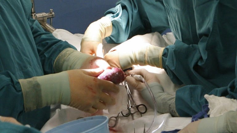 Transplantation einer Niere. (Foto: picture-alliance / Reportdienste, picture alliance / ASSOCIATED PRESS | Al Hartmann)