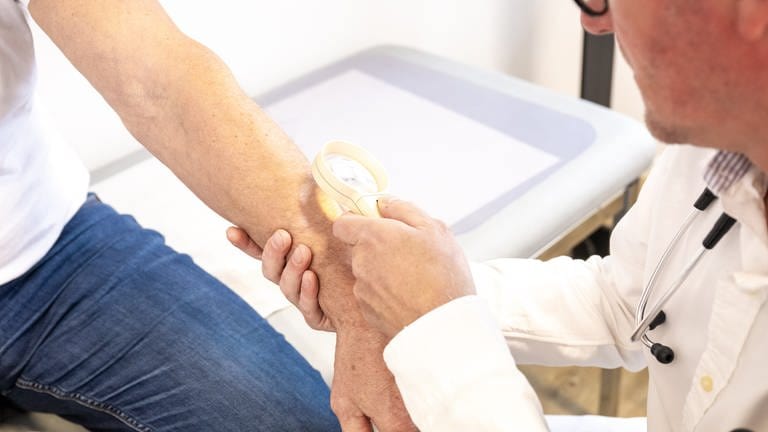 Ein Hausarzt untersucht die Haut am Arm eines Patienten mit Hilfe einer Lupe