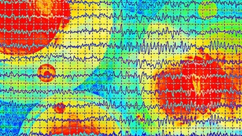 EEG-Gehirnwellen (Foto: IMAGO,  imago images/dusan964)