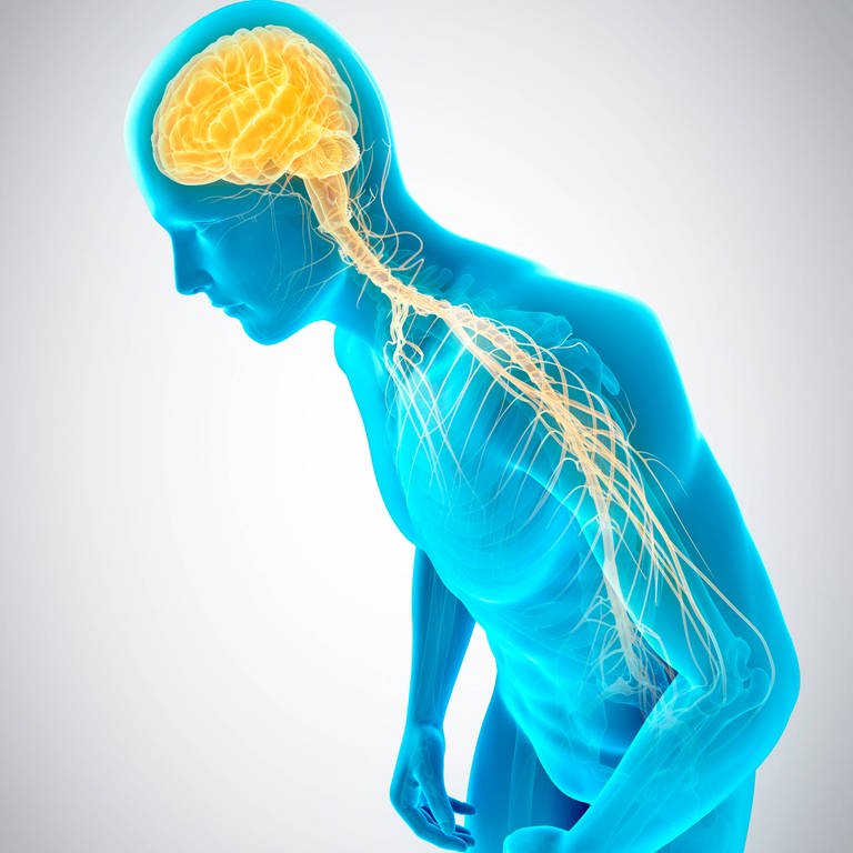 Illustration des Nervensystems: Eine Person beugt sich vornüber. Bei Parkinson-Patienten werden die Befehle aus dem Gehirn nicht richtig in die Beine gesandt. Symbolbild. (Foto: IMAGO, Science Photo Library)