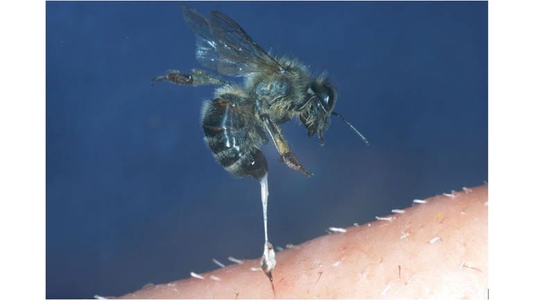 Biene reißt sich nach Stich ihren Stachel heraus. Das Gift der Biene war vor ihrem Stachel vorhanden. (Foto: picture-alliance / Reportdienste, picture alliance / blickwinkel/Hecker/Sauer | Hecker/Sauer)