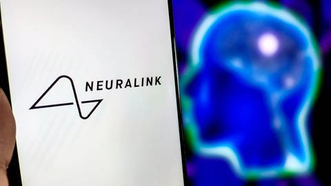 Wenn ein Mensch zu einer Bewegung ansetzt, wird ein bestimmter Bereich im Gehirn aktiv. Diese Signale soll der implantierte Chip messen und interpretieren. Die Firma von Elon Musk heißt Neurolink.