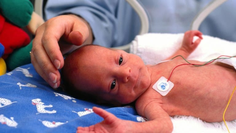 Frühgeborene werden im Inkubator versorgt (Foto: IMAGO, imago images / blickwinkel)
