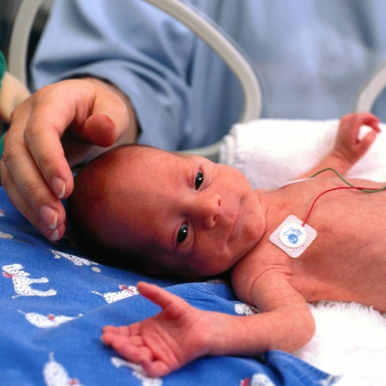 Frühgeborene werden im Inkubator versorgt