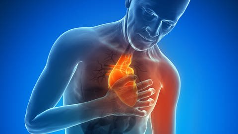Bluthochdruck kann erhebliche gesundheitliche Folgen haben. Unter anderem steigt das Risiko für einen Herzinfarkt.