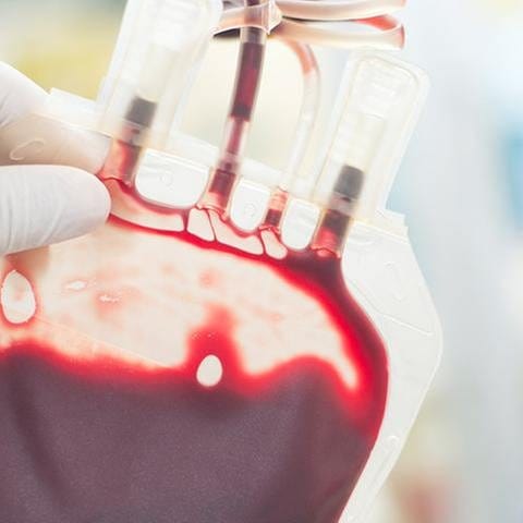 Bluttransfusion (Foto: Getty Images, Getty Images - toeytoey2530)