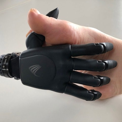 Die reparierte Handprothese von Isabelle (Foto: Lothar Nickels)