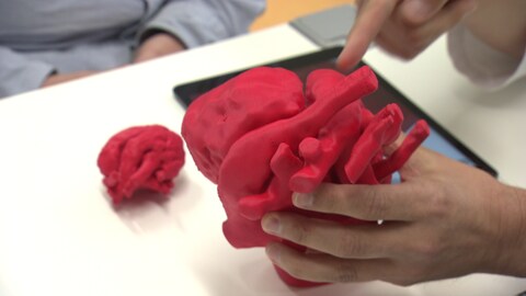 3D Kinderherz - Das Herzmodell (Foto: SWR) 3D Kinderherz - Das Herzmodell