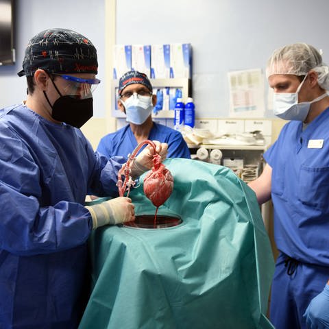 Mitglieder des Operationsteams zeigen im Januar 2022 das Schweineherz, das dem Patienten David Bennett transplantiert werden soll. Das Foto wurde von der Maryland School of Medicine zur Verfügung gestellt. Der Patient starb zwei Monate später.